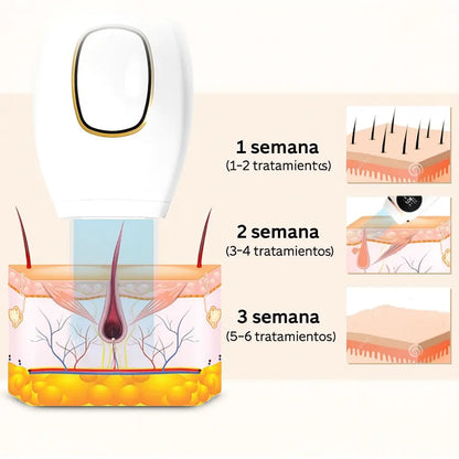 Depilador Láser IPL – Belleza y Comodidad sin Cuchillas