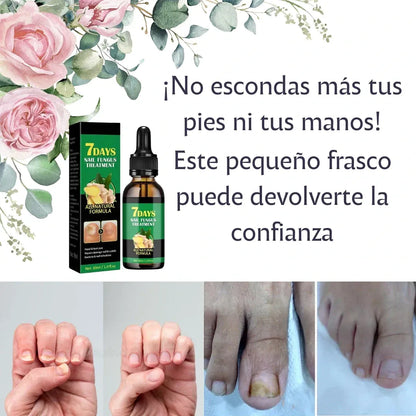 7 Days Antihongos y Fortalecedor de Uñas – Uñas limpias, fuertes y con brillo natural